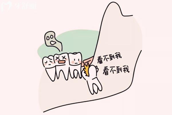 智齒經(jīng)常發(fā)炎一定要拔嗎