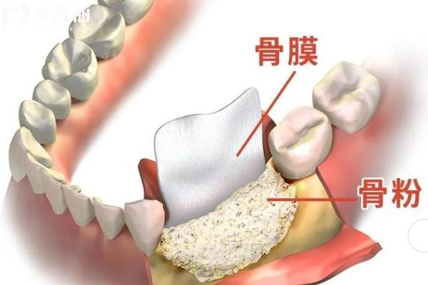 金華口腔醫(yī)院種植牙集采價(jià)格收費(fèi)