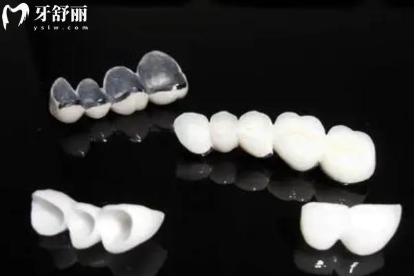 宿遷看牙貴不貴？宿遷口腔醫(yī)院價(jià)格表