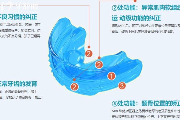 兒童下頜后縮矯正黃金年齡