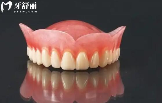 吸附性義齒多少錢？價格表與影響因素