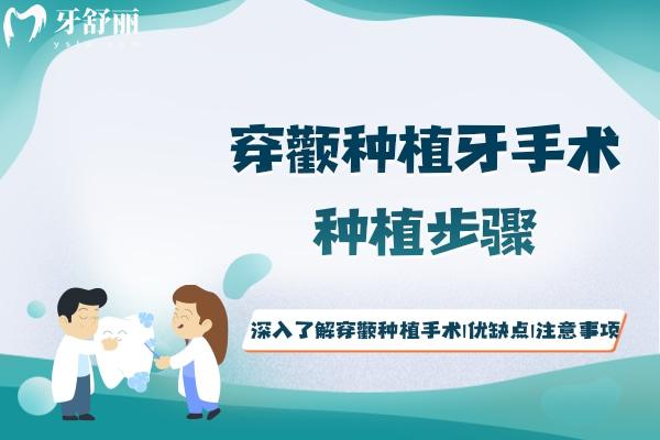 深入了解穿顴種植手術(shù)