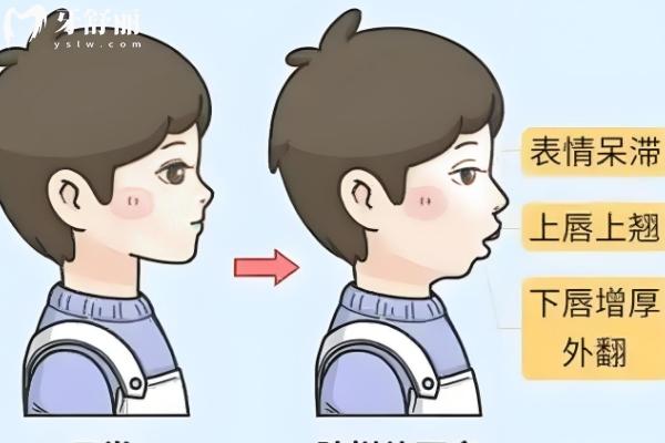 西安牙齒矯正價(jià)格表更新