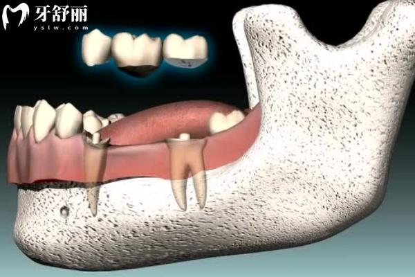 西寧時光諾貝爾口腔收費標(biāo)準(zhǔn)更新