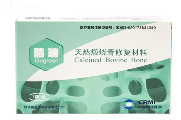 揭露種牙骨粉十大品牌榜:對(duì)比國產(chǎn)/進(jìn)口骨粉作用和功效還有價(jià)格分享