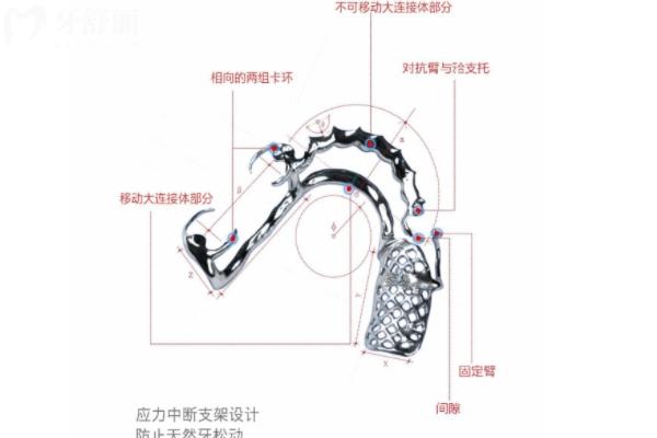 假牙支架選維他靈的還是純鈦的好