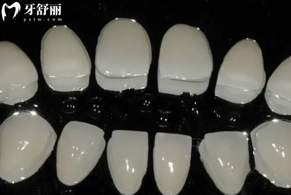 瓷貼面和樹脂貼面有什么區(qū)別?從材質(zhì)/美觀度/使用壽命/價格深度對比