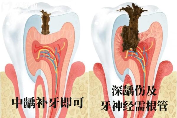 許昌口腔醫(yī)院牙科收費(fèi)價(jià)目表