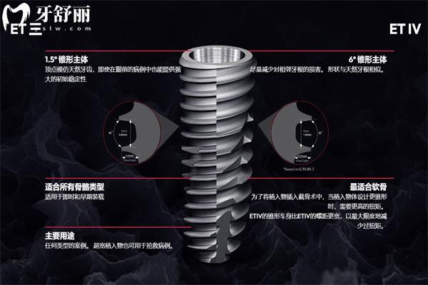 種牙什么牌子的性價比高?2025年國內(nèi)十大流行種植牙品牌排行榜來了解下