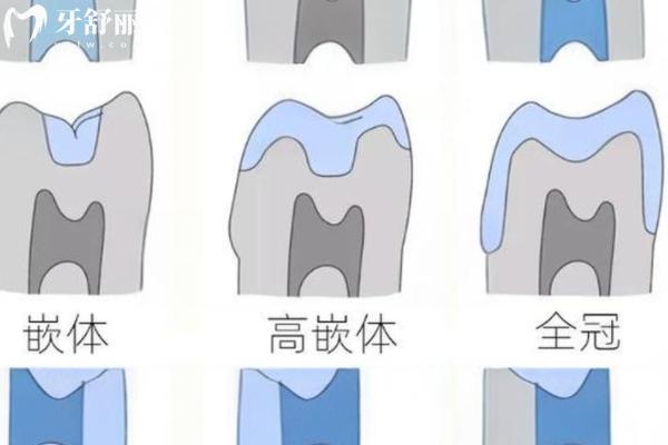 寧波北侖口腔醫(yī)院價(jià)格貴嗎?