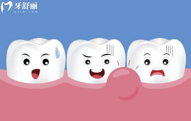 牙齦炎和牙齦癌早期鑒別診斷要點(diǎn)
