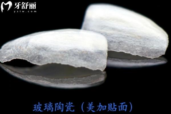 藍瓷貼面vs琥珀瓷貼面哪個好