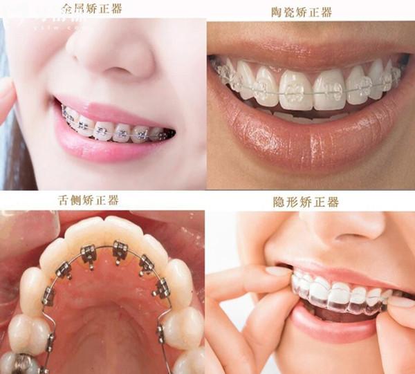 弗萊堡口腔醫(yī)院2025年收費標(biāo)準(zhǔn)(透明不坑):半口種植牙1.96W+全瓷牙1000+根管治療480+