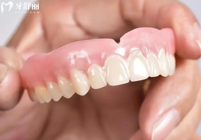 重慶裝活動(dòng)義齒多少錢