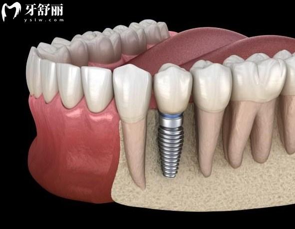 重慶正規(guī)牙科醫(yī)院推薦