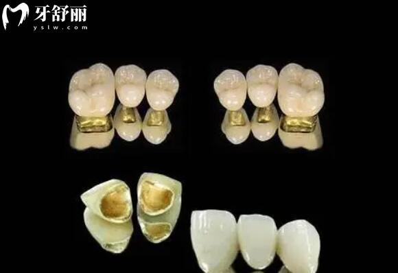 南通美奧口腔醫(yī)院收費(fèi)合理且透明(不坑),2025年價(jià)目表:進(jìn)口種植牙3380+半口吸附義齒1.3W