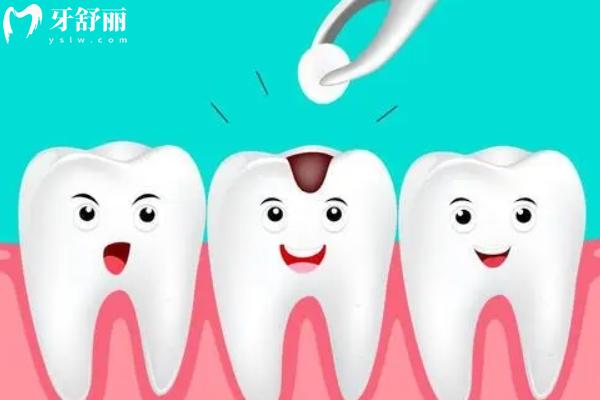 惠州補牙多少錢一顆？