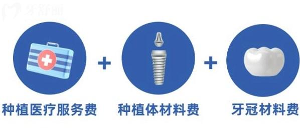 做一顆種植牙包含哪些費用