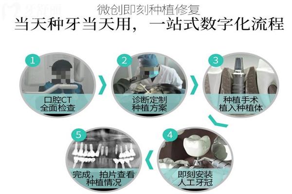 做一顆種植牙包含哪些費用