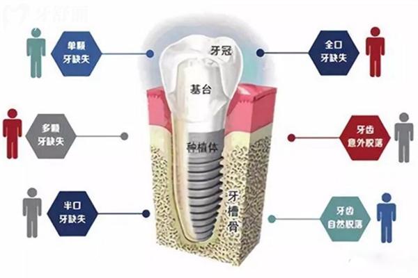 全新的太原口腔醫(yī)院價目表在這里!種植牙2200+牙齒矯正6800+拔牙68+