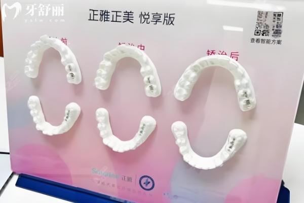 湛江矯正牙齒好醫(yī)院排行榜