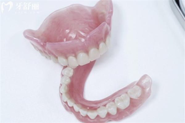 2025北京老年人全口假牙價目表更新:種植牙3.6w+吸附牙1.8w+活動牙3k+
