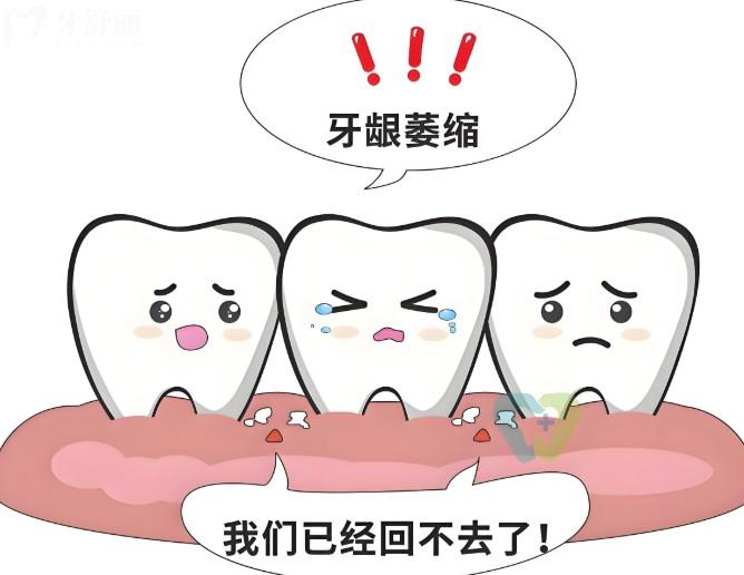 什么是牙齦萎縮