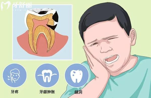爛牙根發(fā)黑腐爛