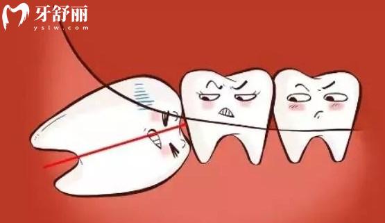 智齒拔除后的牙洞那么大?它是怎么愈合呢?