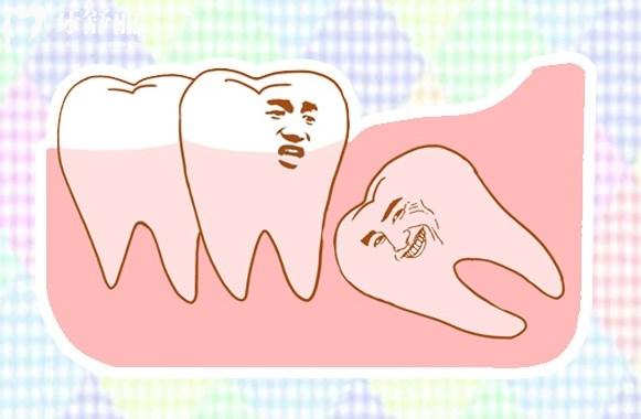 拔智齒術(shù)后黃金護理法則：避免干槽癥的關(guān)鍵