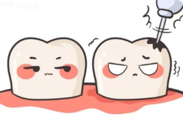 昆明補(bǔ)牙齒哪家醫(yī)院好又不貴?