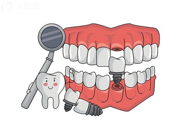 廣州荔灣區(qū)正規(guī)口腔醫(yī)院價(jià)格表