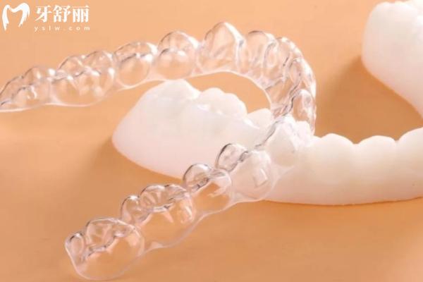 國產(chǎn)美立刻隱形矯正靠譜嗎？