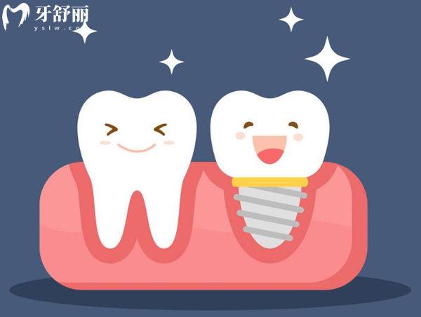 嘉興口腔醫(yī)院種植牙價(jià)格是多少