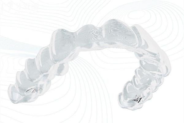 鋼牙套與隱形牙套：哪種矯正結(jié)果更快