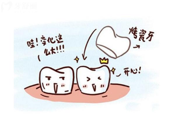 全瓷牙都有什么牌子？優(yōu)缺點(diǎn)都有哪些？一文了解全瓷牙
