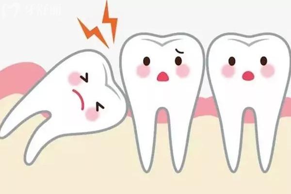 智齒會(huì)導(dǎo)致一整排牙痛嗎