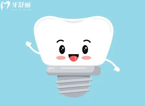 必看種植牙十大品牌中瑞士ITI/瑞典諾貝爾/韓國登騰/美國皓圣優(yōu)勢及價格表