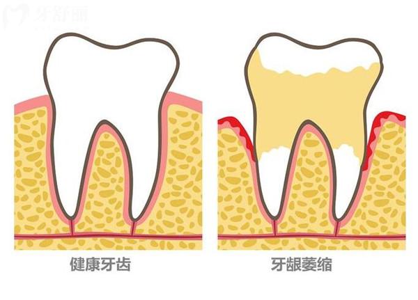南通美特美口腔收費(fèi)價(jià)格表
