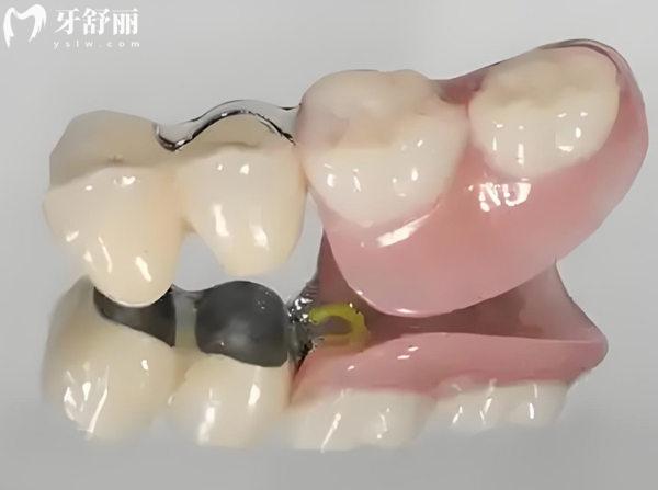 蘭州口腔醫(yī)院收費(fèi)價(jià)目表