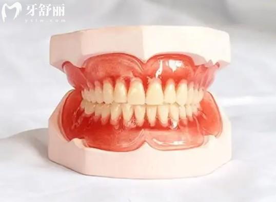 吸附性義齒日常護理秘籍