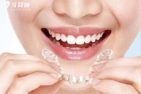 上海牙齒矯正多少錢2025價(jià)格表