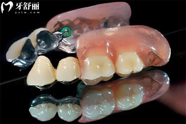 裝假牙哪個醫(yī)院質(zhì)量好價格低?深圳/北京/廣州/上海等中老年鑲牙口腔名單分享