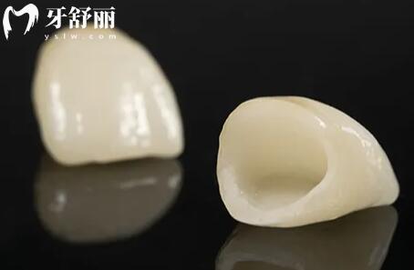 成都安牙齒多少錢一顆?2025年價格表:烤瓷牙800+/全瓷冠1500/種植牙1980+