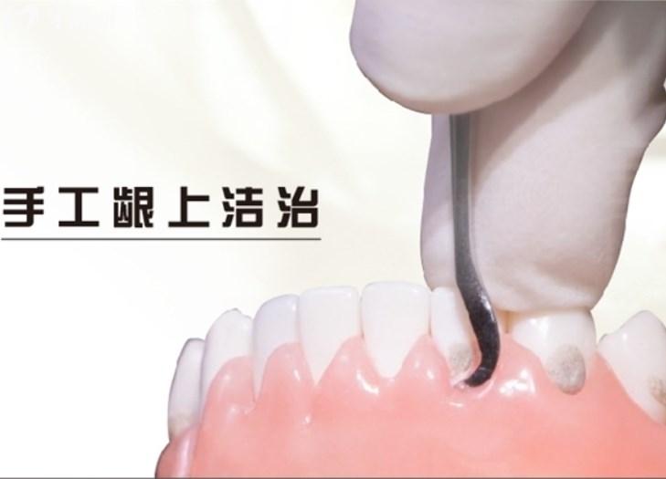 齦下刮治到底疼不疼?看過牙科齦下刮治術(shù)操作流程圖便知