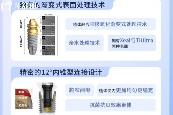 諾貝爾金致Cc和金致PCC區(qū)別