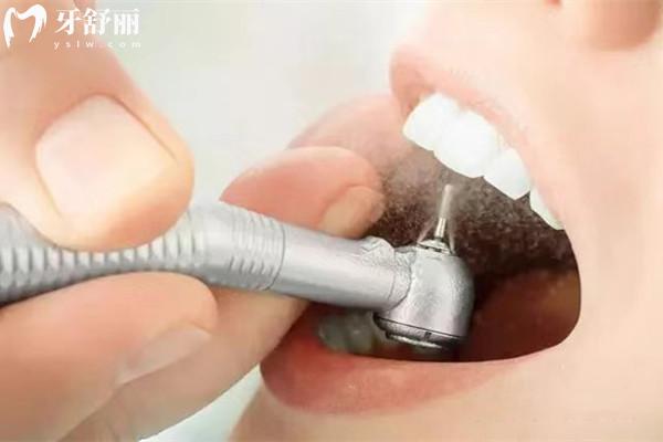 杭州鼎植口腔醫(yī)院怎么樣