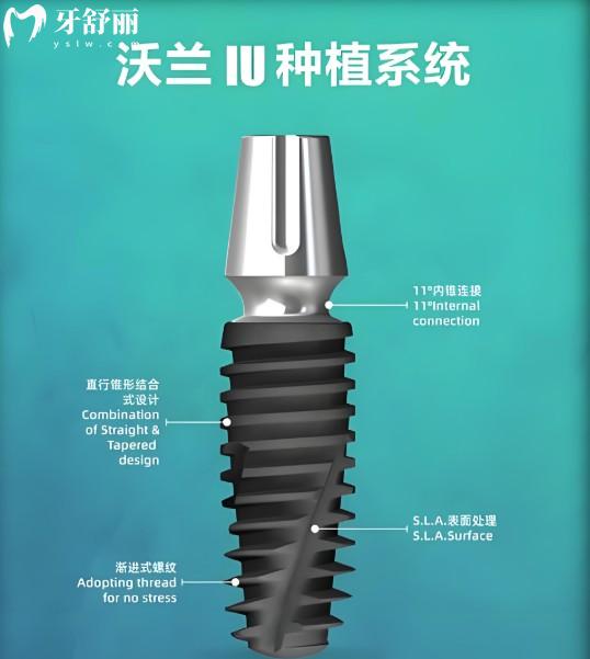 韓國沃蘭種植牙的優(yōu)缺點(diǎn)分析