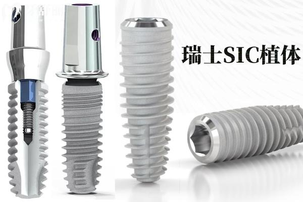 種植牙哪個(gè)品牌材料好性價(jià)比高 對(duì)比十大常用種植牙品牌優(yōu)缺點(diǎn)便知