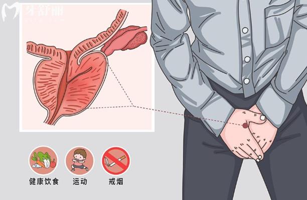 國內(nèi)睪丸切除手術(shù)問題詢問